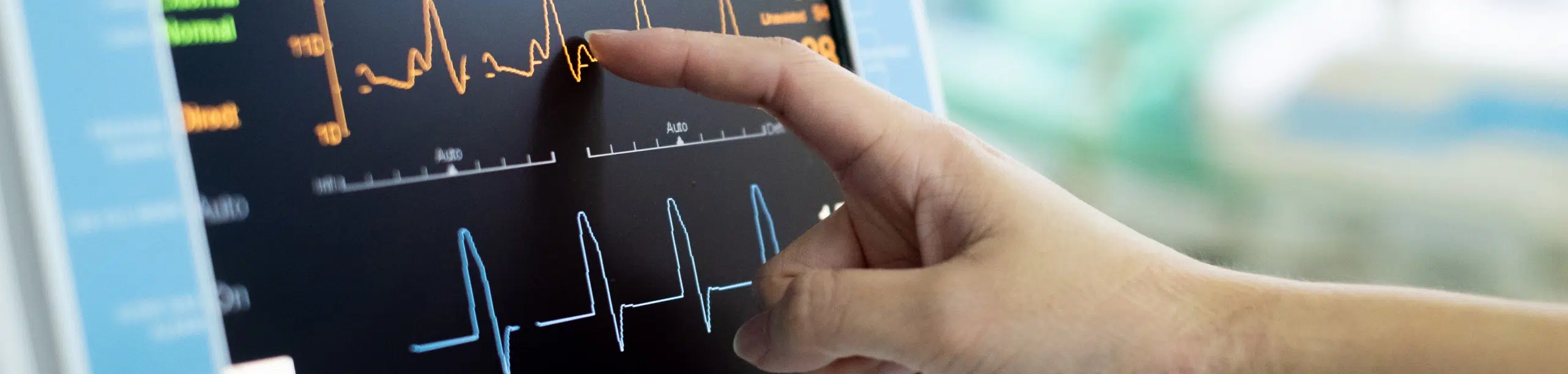 Affections cardio-vasculaire | Clinalliance SMR | Île-de-France