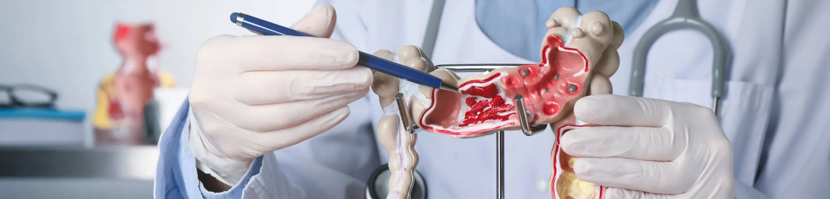 Quels sont les 4 rôles du tube digestif ? | Clinalliance | SMR SSR